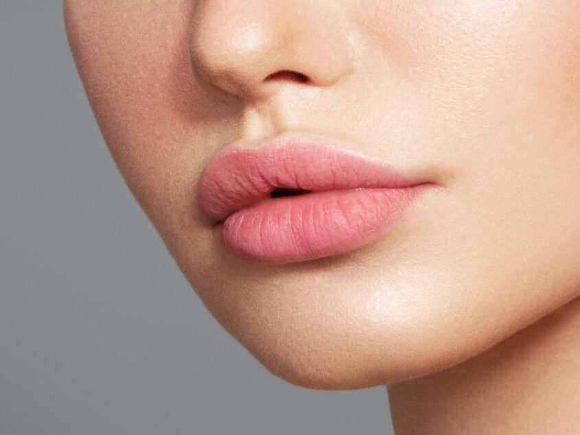Medspact What Causes Scarred Lips And How To Get Rid Of It