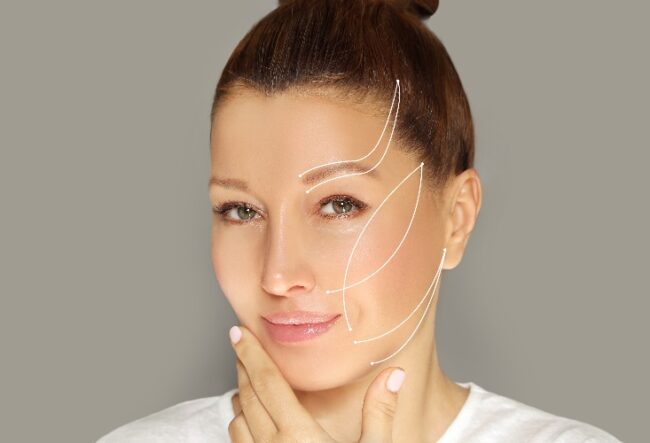 MINT™ (Minimally Invasive Nonsurgical Thread) PDO Lifts for Face and Body