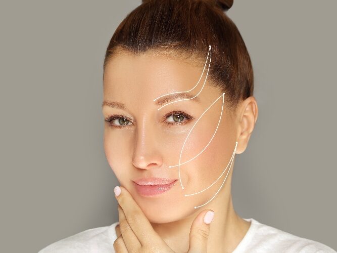 PDO Lifts for Face and Body MINT™ (Minimally Invasive Nonsurgical Thread) PDO Lifts for Face and Body